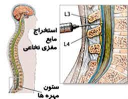 اسلاید آموزشی با عنوان کشت مایع مغزی نخاعی