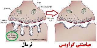 اسلاید آموزشی با عنوان میاستنی گراو